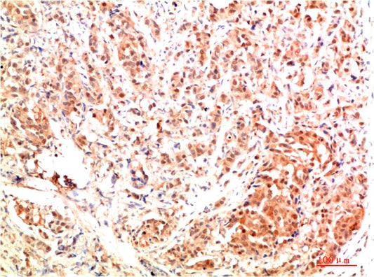 ERK1 Polyclonal Antibody (ERK1）
