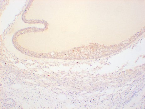 AMH Polyclonal Antibody
