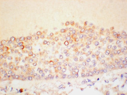 AMH Polyclonal Antibody