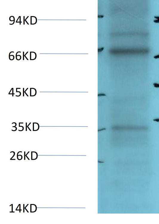 HSD11B1 Polyclonal Antibody