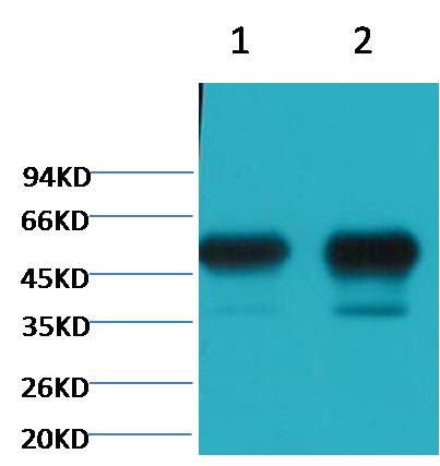Beta II tubulin Monoclonal Antibody (Mix-mA™) (Rodent Preferred)