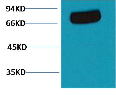 Transferrin Monoclonal Antibody (7F4)
