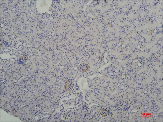 TBP TATA Binding Protein Monoclonal Antibody (1F6)