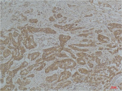 Alpha-tubulin (Acetyl Lys40) Monoclonal Antibody (4A8)