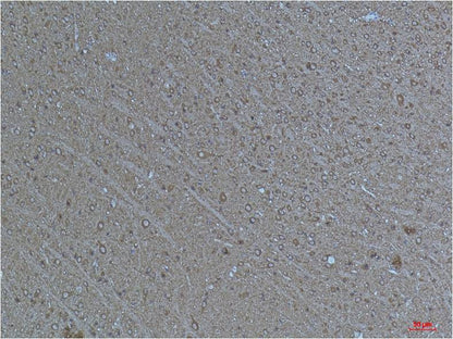 Alpha-tubulin (Acetyl Lys40) Monoclonal Antibody (4A8)