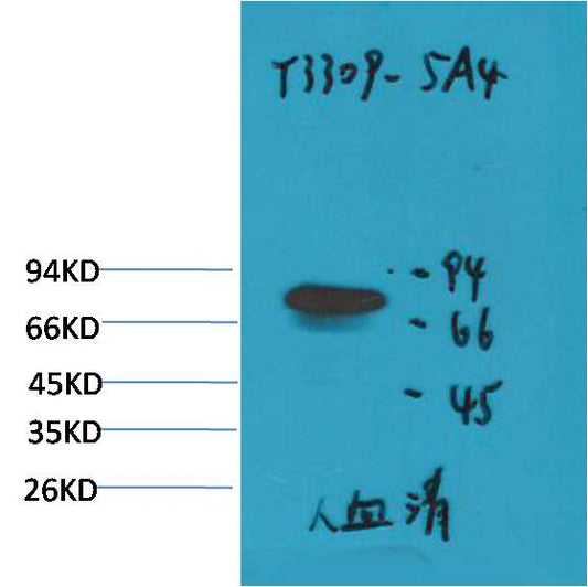 Transferrin Monoclonal Antibody (5A4)