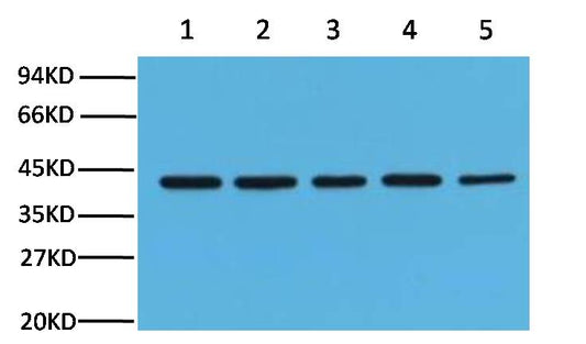 Beta-actin Monoclonal Antibody (5B7)