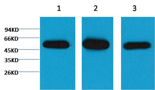 Beta I tubulin Monoclonal Antibody (3F7)