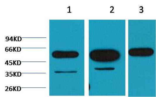 Beta-tubulin Monoclonal Antibody (M7)