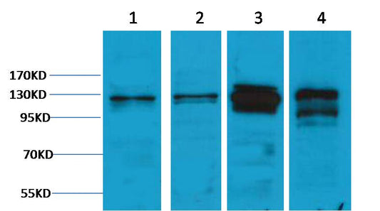 Vinculin Polyclonal Antibody