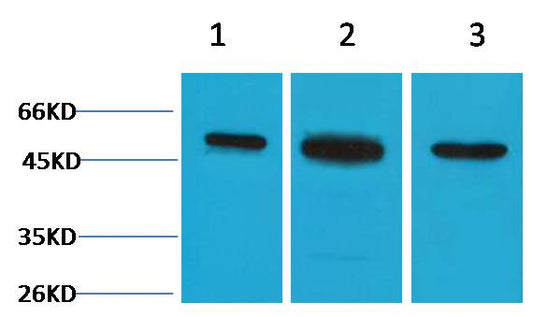Beta II Tubulin Polyclonal Antibody
