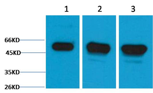Beta III Tubulin Polyclonal Antibody