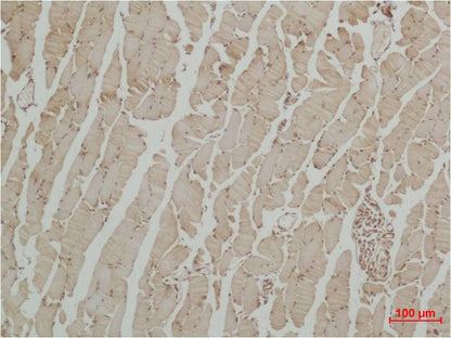 Beta III Tubulin Polyclonal Antibody