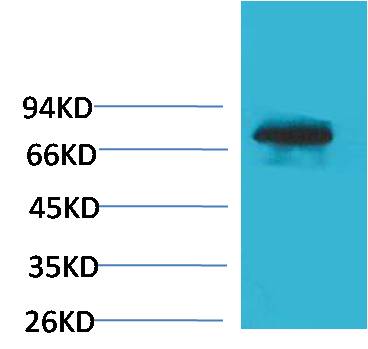 Transferrin Polyclonal Antibody