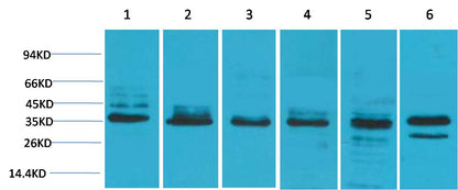 TBP Polyclonal Antibody (TBP)