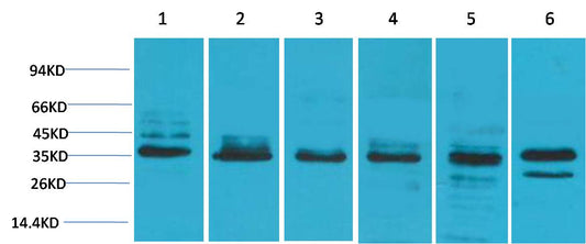 TBP Polyclonal Antibody (TBP)