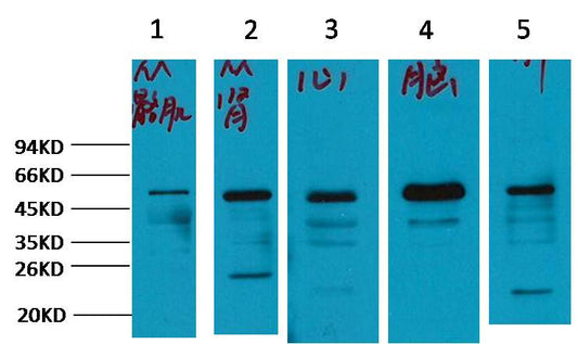 Alpha-tubulin Polyclonal Antibody