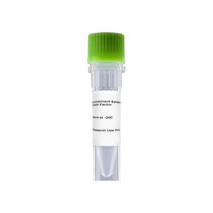 Recombinant Human IL-1R1 (C-6His)